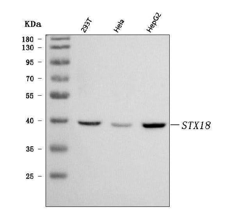 Anti-Syntaxin 18/STX18 Antibody Picoband® Boster Bio