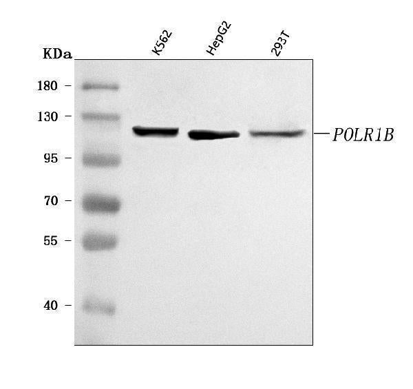 Anti-POLR1B Antibody Picoband® Boster Bio