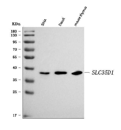 Anti-SLC35D1 Antibody Picoband® Boster Bio