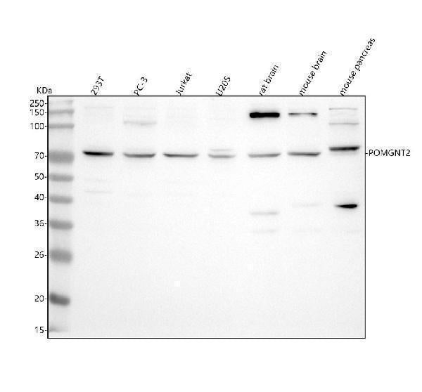 Anti-POMGNT2 Antibody Picoband® Boster Bio