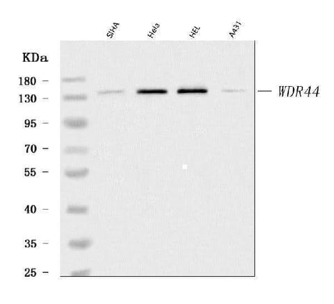 Anti-WDR44 Antibody Picoband® Boster Bio