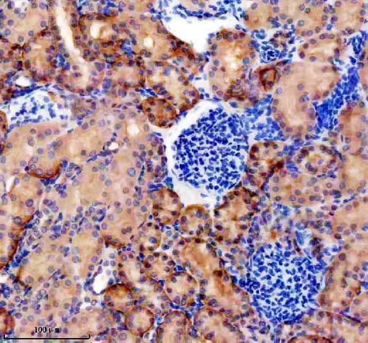 Anti-OSTbeta/SLC51B Antibody Boster Bio