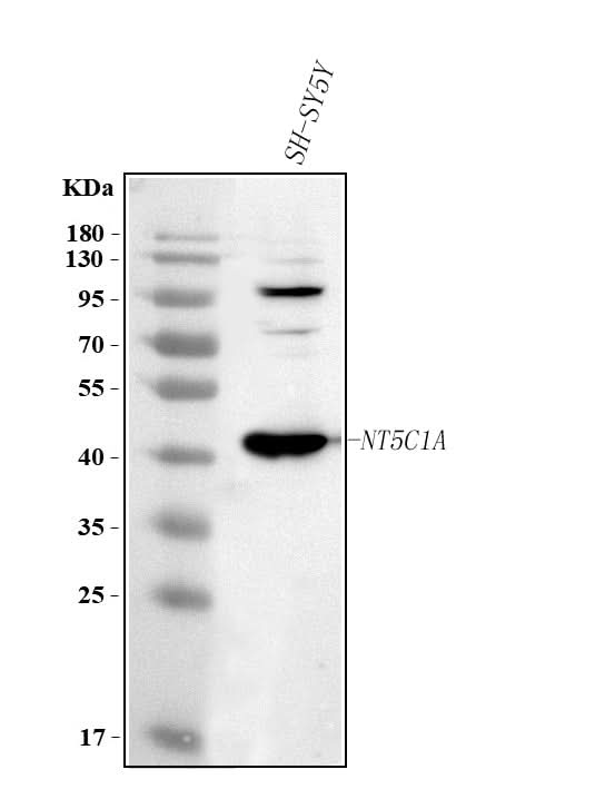 Anti-NT5C1A Antibody Picoband® Boster Bio