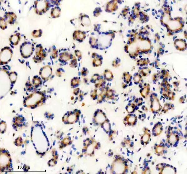 Anti-TENM2 Antibody Boster Bio