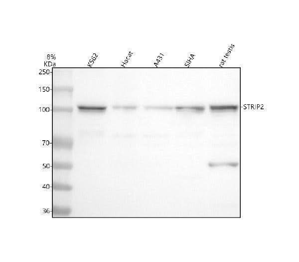 Anti-FAM40B/STRIP2 Antibody Picoband® Boster Bio