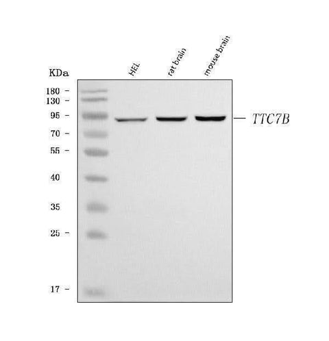 Anti-TTC7B Antibody Picoband® Boster Bio