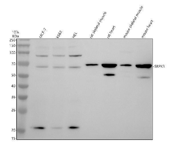 Anti-SRPK3 Antibody Picoband® Boster Bio