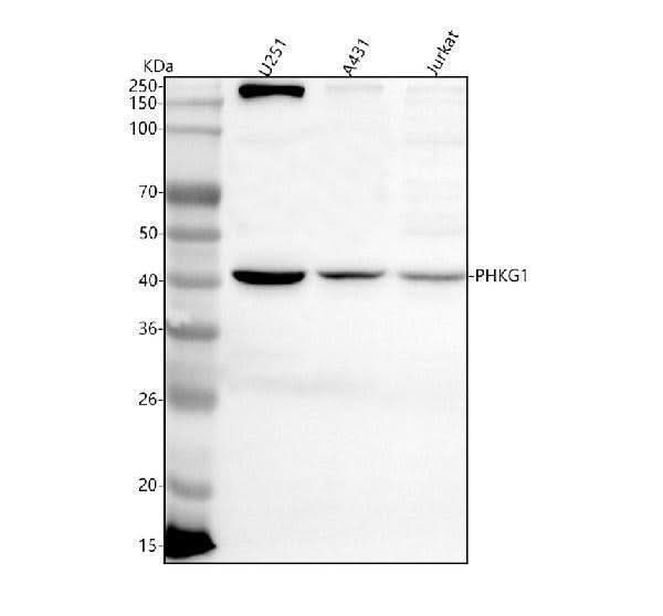 Anti-PHKG1 Antibody Picoband® Boster Bio