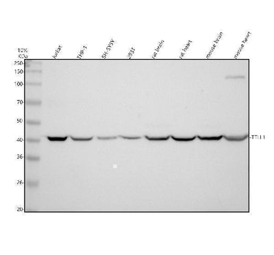 Anti-TTLL1 Antibody Picoband® Boster Bio