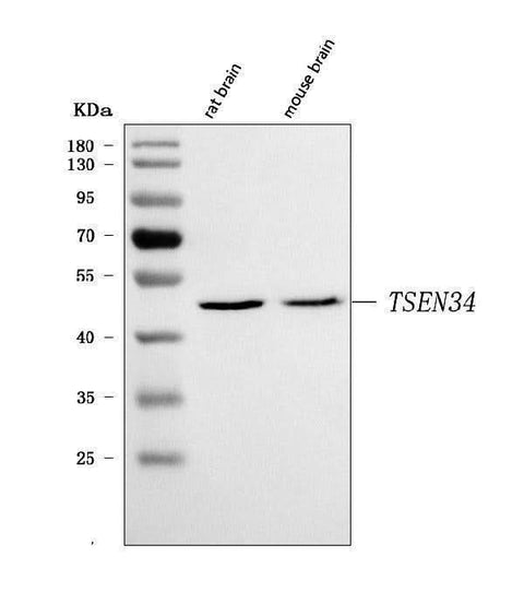 Anti-TSEN34 Antibody Picoband® Boster Bio