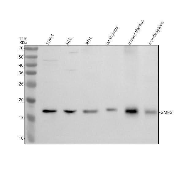 Anti-GMFG Antibody Picoband® Boster Bio