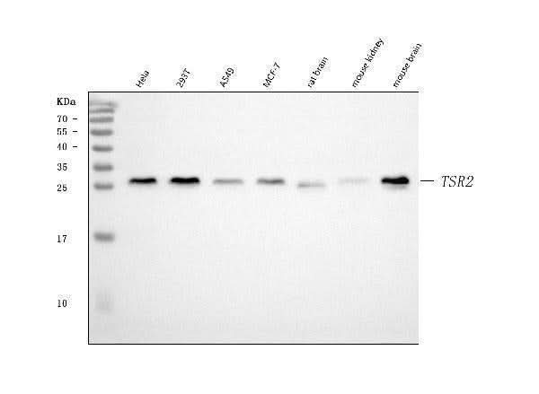 Anti-TSR2 Antibody Picoband® Boster Bio