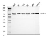 Anti-TARS2 Antibody Picoband® Boster Bio