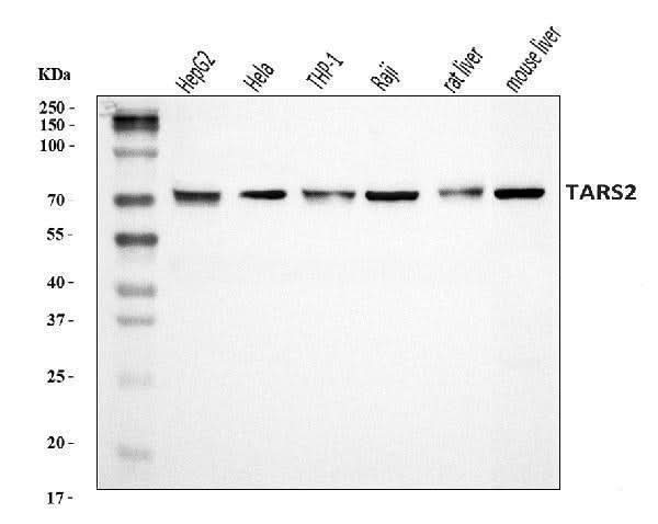 Anti-TARS2 Antibody Picoband® Boster Bio