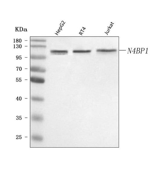 Anti-N4BP1 Antibody Picoband® Boster Bio