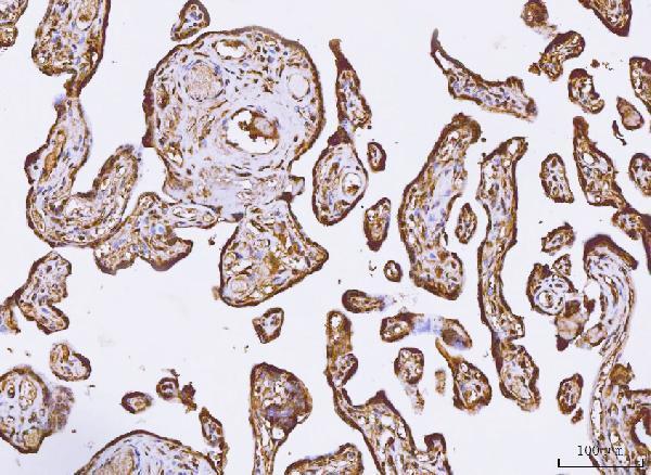 Anti-PKIB Antibody Boster Bio