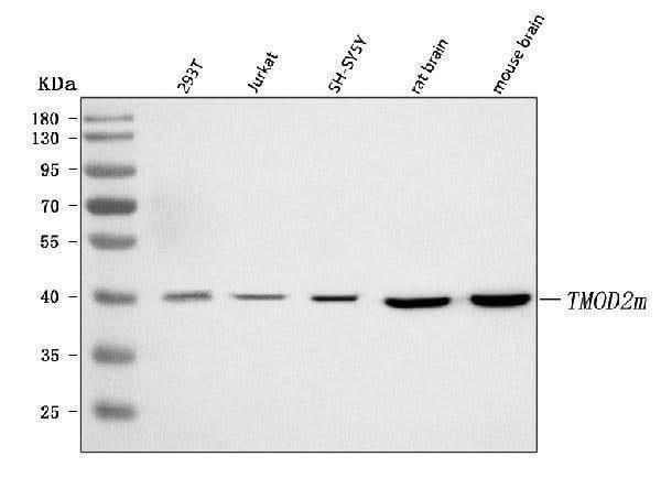 Anti-TMOD2 Antibody Picoband® Boster Bio