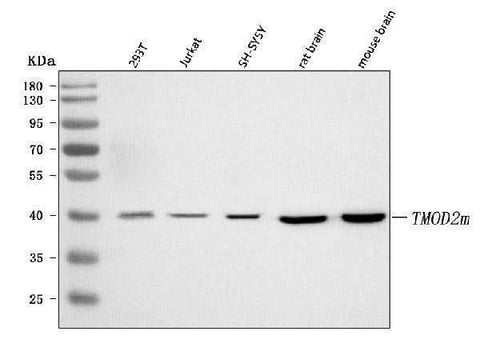 Anti-TMOD2 Antibody Picoband® Boster Bio