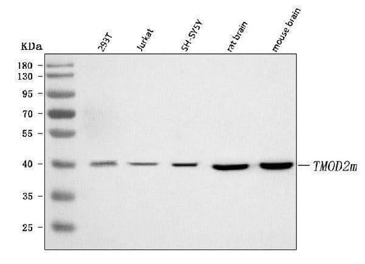 Anti-TMOD2 Antibody Picoband® Boster Bio