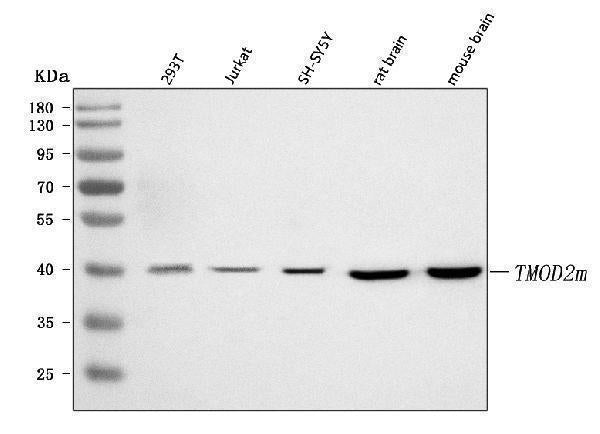 Anti-TMOD2 Antibody Picoband® Boster Bio