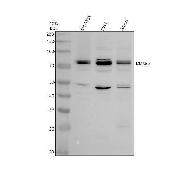 Anti-DDX59 Antibody Picoband® Boster Bio