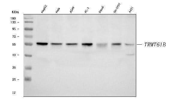 Anti-TRMT61B Antibody Picoband® Boster Bio