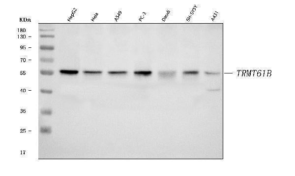 Anti-TRMT61B Antibody Picoband® Boster Bio