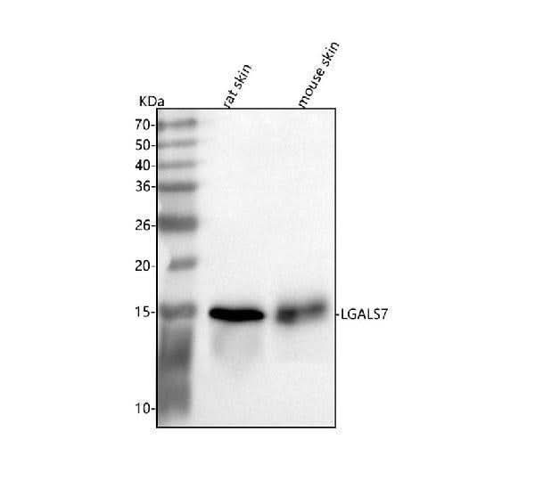 Anti-Galectin-7/LGALS7 Antibody Picoband® Boster Bio