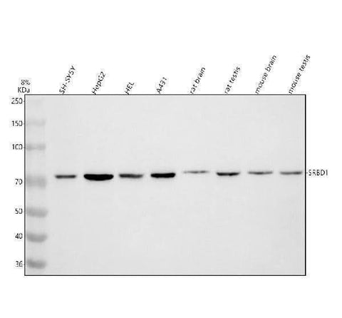 Anti-SRBD1 Antibody Picoband® Boster Bio