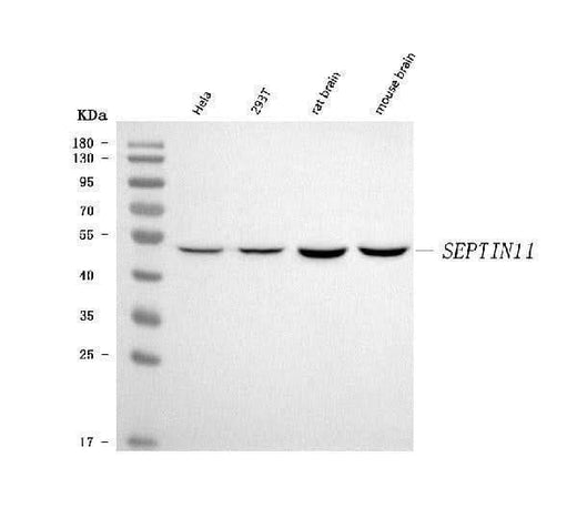 Anti-Septin 11/SEPTIN11 Antibody Picoband® Boster Bio