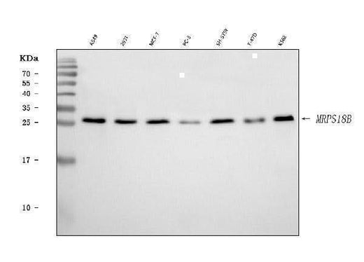 Anti-MRPS18B Antibody Picoband® Boster Bio