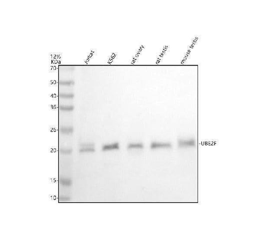 Anti-UBE2F Antibody Picoband® Boster Bio