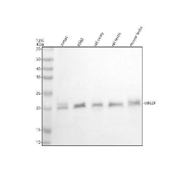 Anti-UBE2F Antibody Picoband® Boster Bio