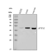 Anti-IFT52 Antibody Picoband® Boster Bio