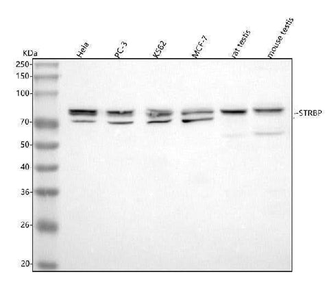 Anti-STRBP Antibody Picoband® Boster Bio