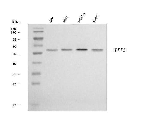 Anti-TTI2 Antibody Picoband® Boster Bio