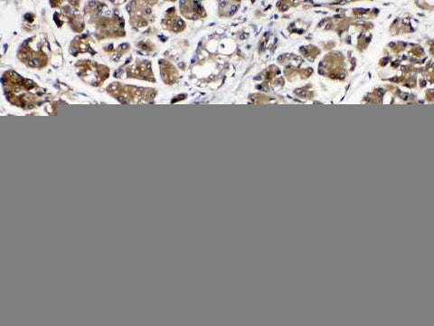 Anti-Amylase/AMY1A/AMY1B/AMY1C Antibody Picoband® Boster Bio