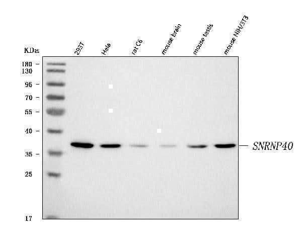 Anti-SNRNP40 Antibody Picoband® Boster Bio