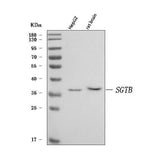 Anti-SGT2/SGTB Antibody Picoband® Boster Bio