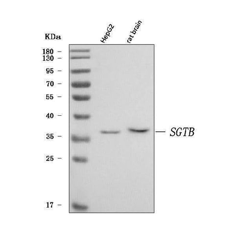 Anti-SGT2/SGTB Antibody Picoband® Boster Bio