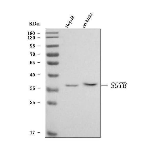 Anti-SGT2/SGTB Antibody Picoband® Boster Bio