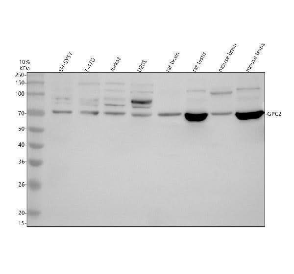 Anti-Glypican 2/GPC2 Antibody Picoband® Boster Bio