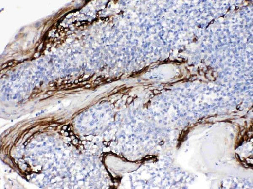 Anti-FDCSP Antibody Boster Bio