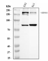 Anti-SBNO1 Antibody Picoband® Boster Bio