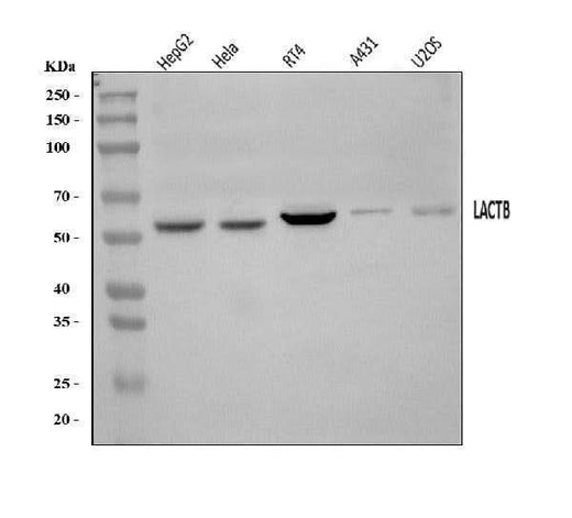 Anti-LACTB Antibody Picoband® Boster Bio