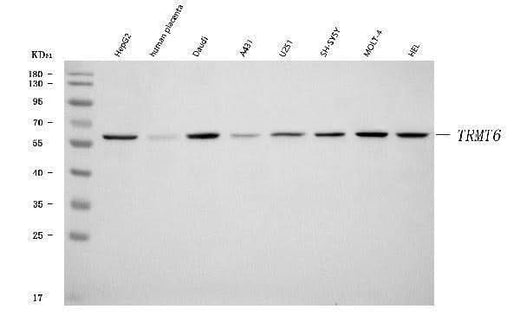 Anti-TRMT6 Antibody Picoband® Boster Bio