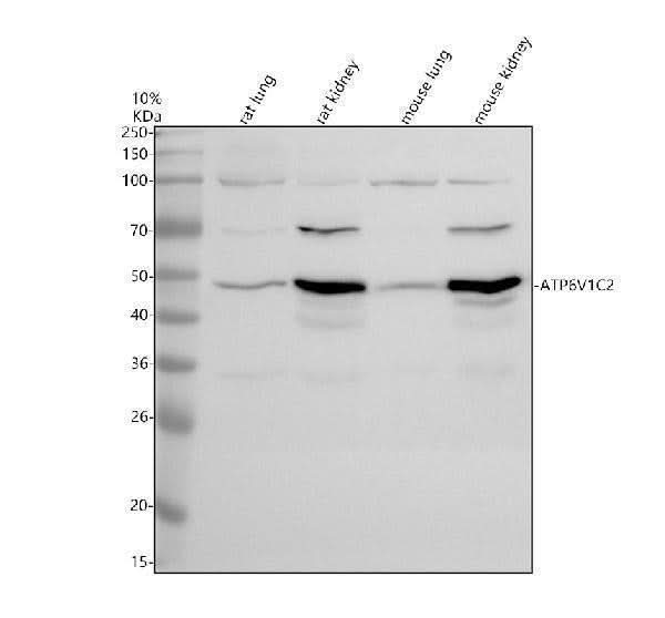 Anti-ATP6V1C2 Antibody Picoband® Boster Bio