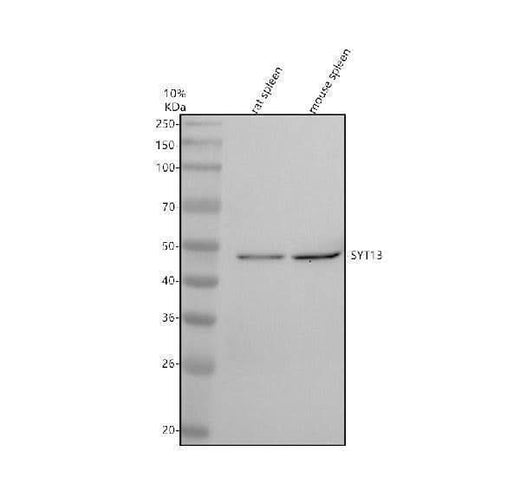 Anti-SYT13 Antibody Picoband® Boster Bio