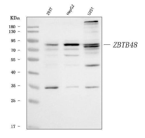 Anti-ZBTB48 Antibody Picoband® Boster Bio