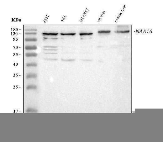 Anti-NARG1L/NAA16 Antibody Picoband® Boster Bio